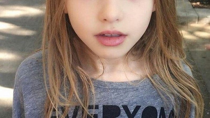 注塑机射嘴，一个容易被低估的关键部件